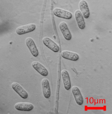 Conidia of Colletotrichum