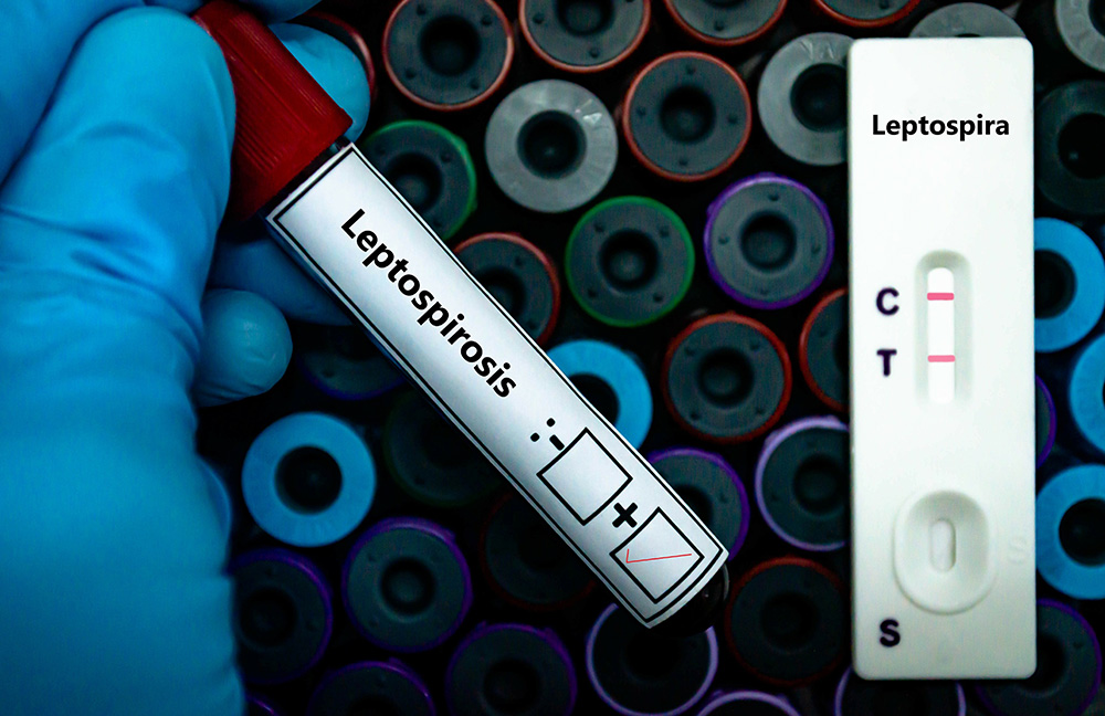  A gloved hand holding a blood sample tube labeled "Leptospirosis" with positive and negative result checkboxes. In the background, there is a rapid test device marked "Leptospira," showing a positive result with two visible lines.